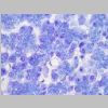 Pancreas SF 17.jpg